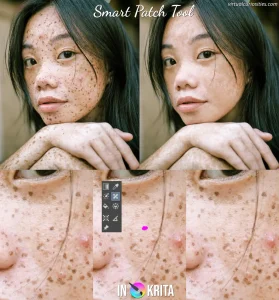 A photo a girl with freckles, before and after the skin was retouched and all the freckles removed. In the end result, the skin texture is still not uniform, and some areas of the face look "smooth" or "flat," in particular the eyebrows and spots under the hair.